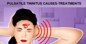 PULSATILE TINNITUS CAUSES=-TREATMENTS